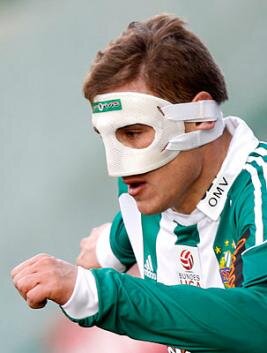 maskeli_balo_var_97b60_400.jpg